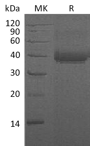 Human CD23 +SDS-PAGE.jpg